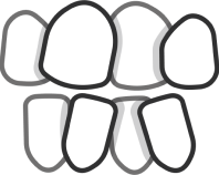 deutsche aligners crowded teeth image
