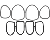 deutsche aligners gap teeth image