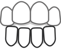 deutsche aligners open bite image