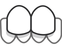 deutsche aligners over bite image